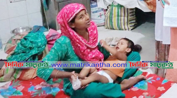 রাজবাড়ীতে হামের উপসর্গ  নিয়ে হাসপাতালে ভর্তি-১৪ 